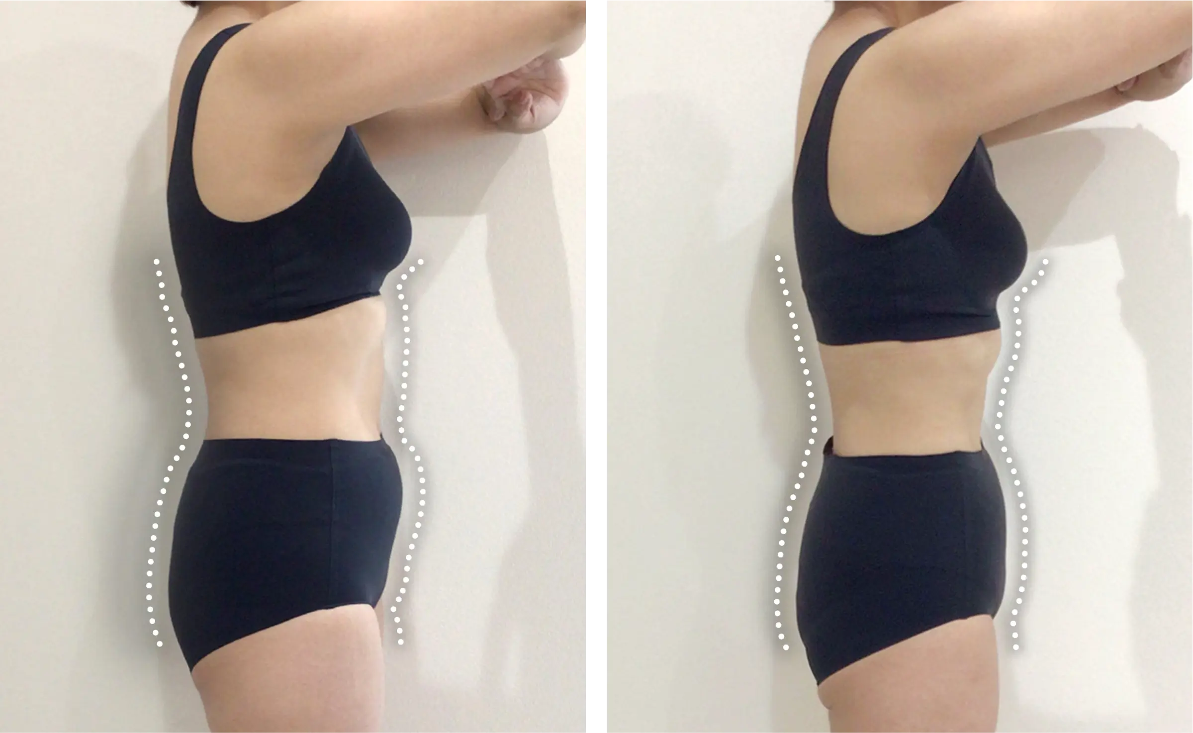 医療ダイエット症例:2カ月で54.6kg→49.3kg（154.5cm・40代女性