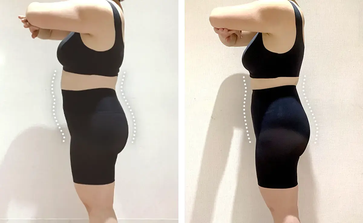 医療ダイエット症例:4カ月で73.8kg→63kg（153cm・40代女性）｜エミ