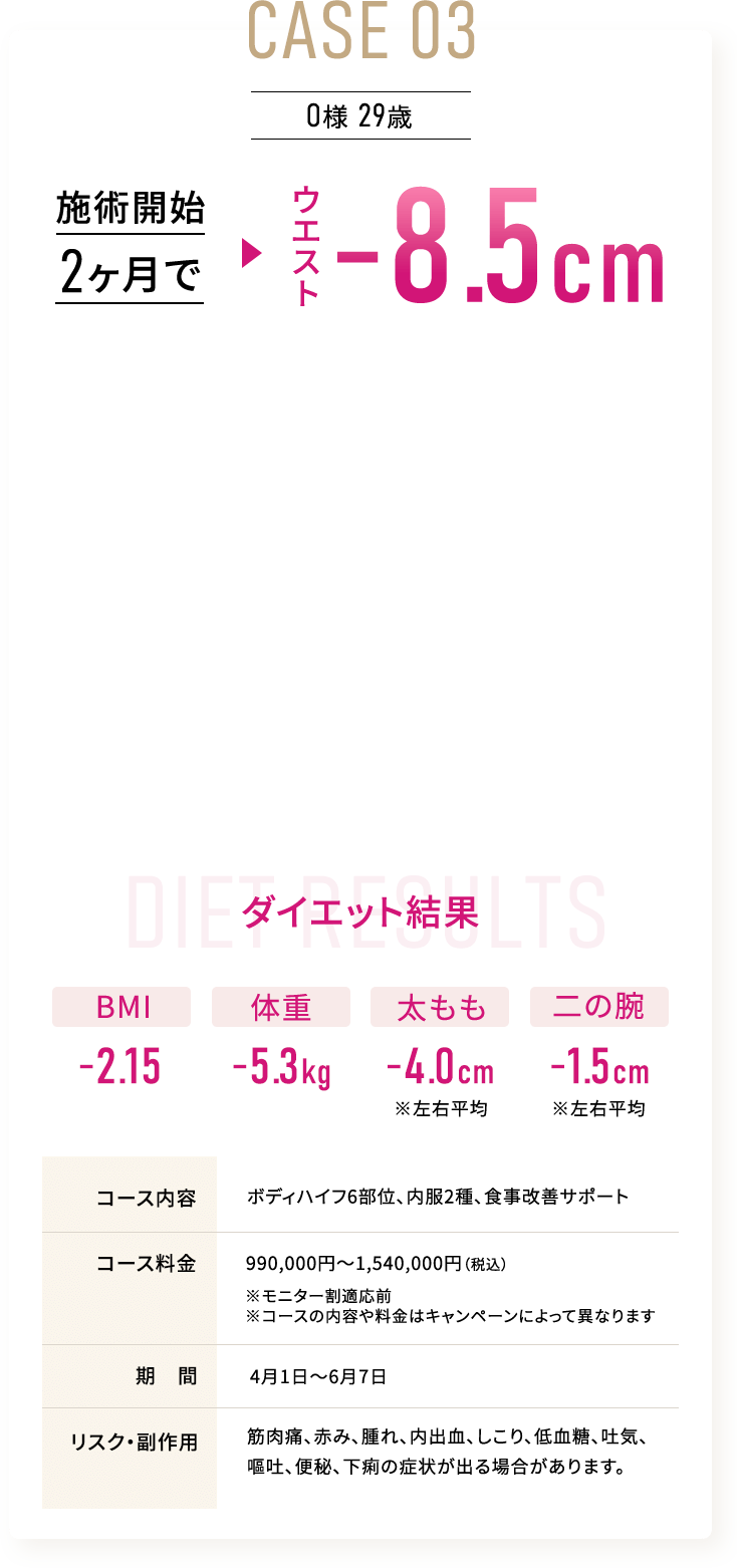 CASE 03  O様 29歳 施術開始2ヶ月でウエスト-8.5cm ダイエット結果 BMI-2.15、体重-5.3kg、太もも-4.0cm ※左右平均、二の腕-1.5cm※左右平均　コース内容 ボディハイフ6部位、内服2種、 食事改善サポート コース料金 990,000円～1,540,000円（税込）※モニター割適応前 ※コースの内容や料金はキャンペーンによって異なります、期間4月1日～6月7日　リスク・副作用　筋肉痛、赤み、腫れ、内出血、しこり、低血糖、吐気、嘔吐、便秘、下痢の症状が出る場合があります。
