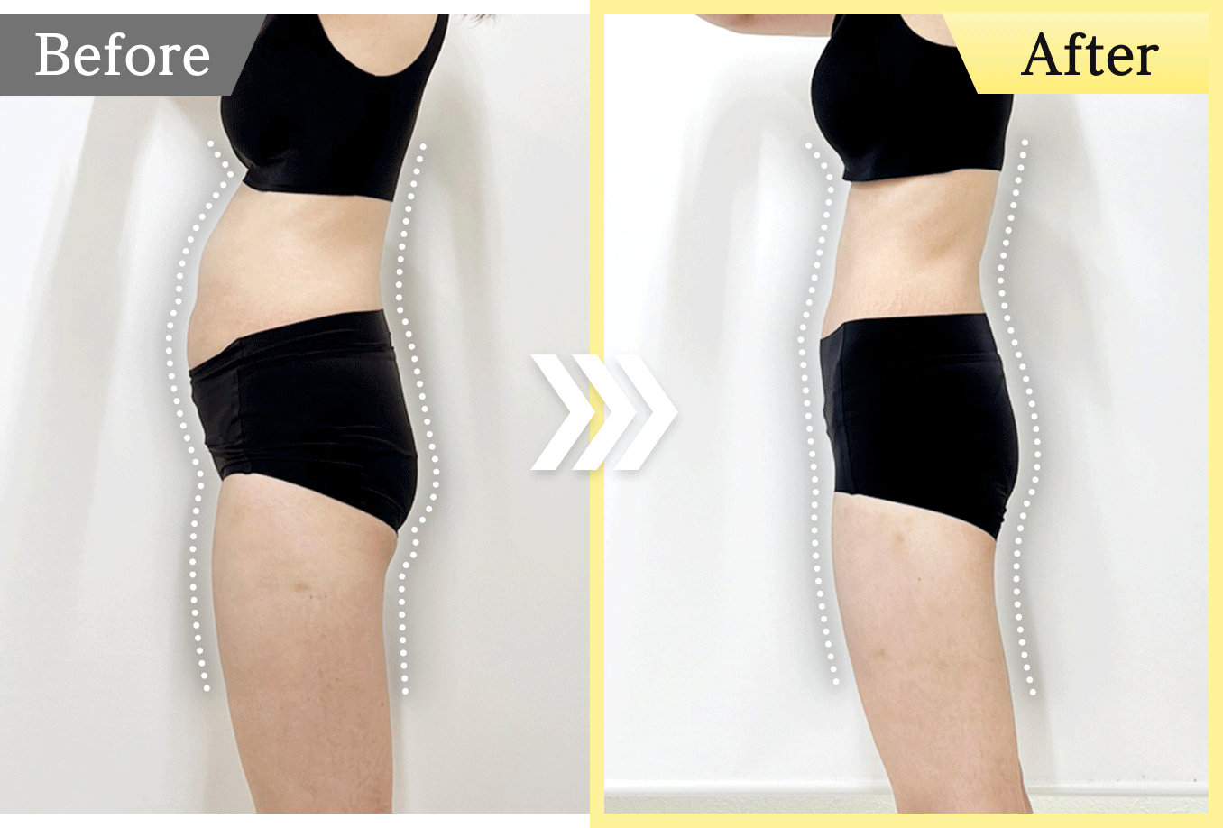 1ヵ月で体重-5kgした症例