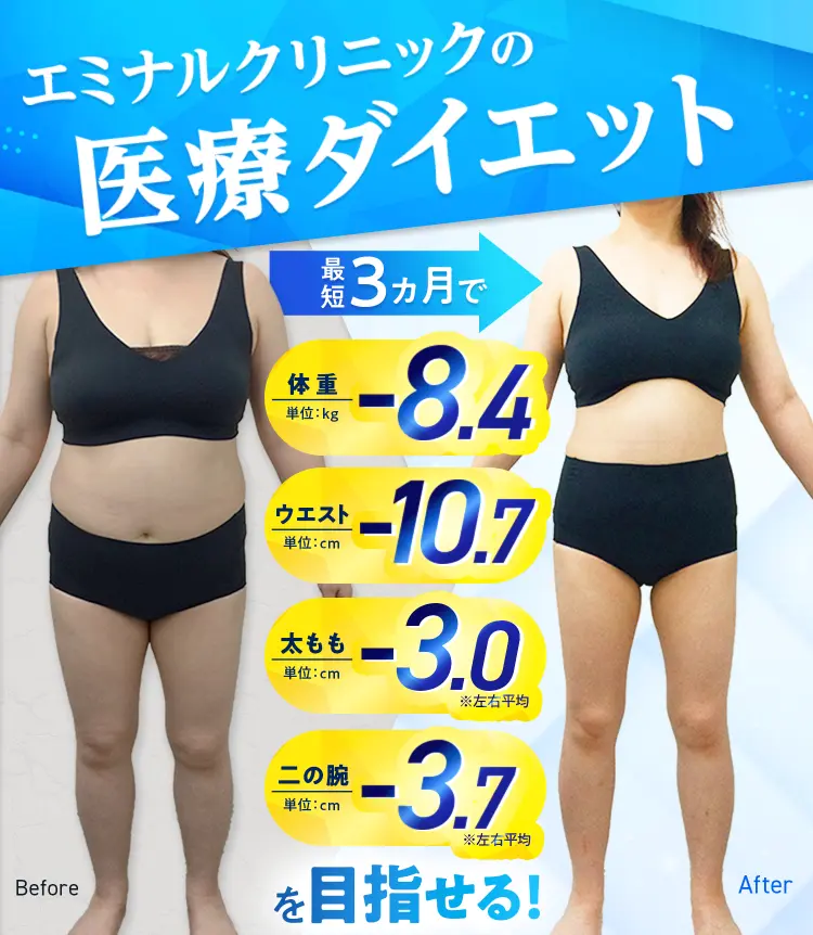 エミナルクリニックの医療ダイエット